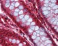 CASP8 / Caspase 8 Antibody (C-Terminus)